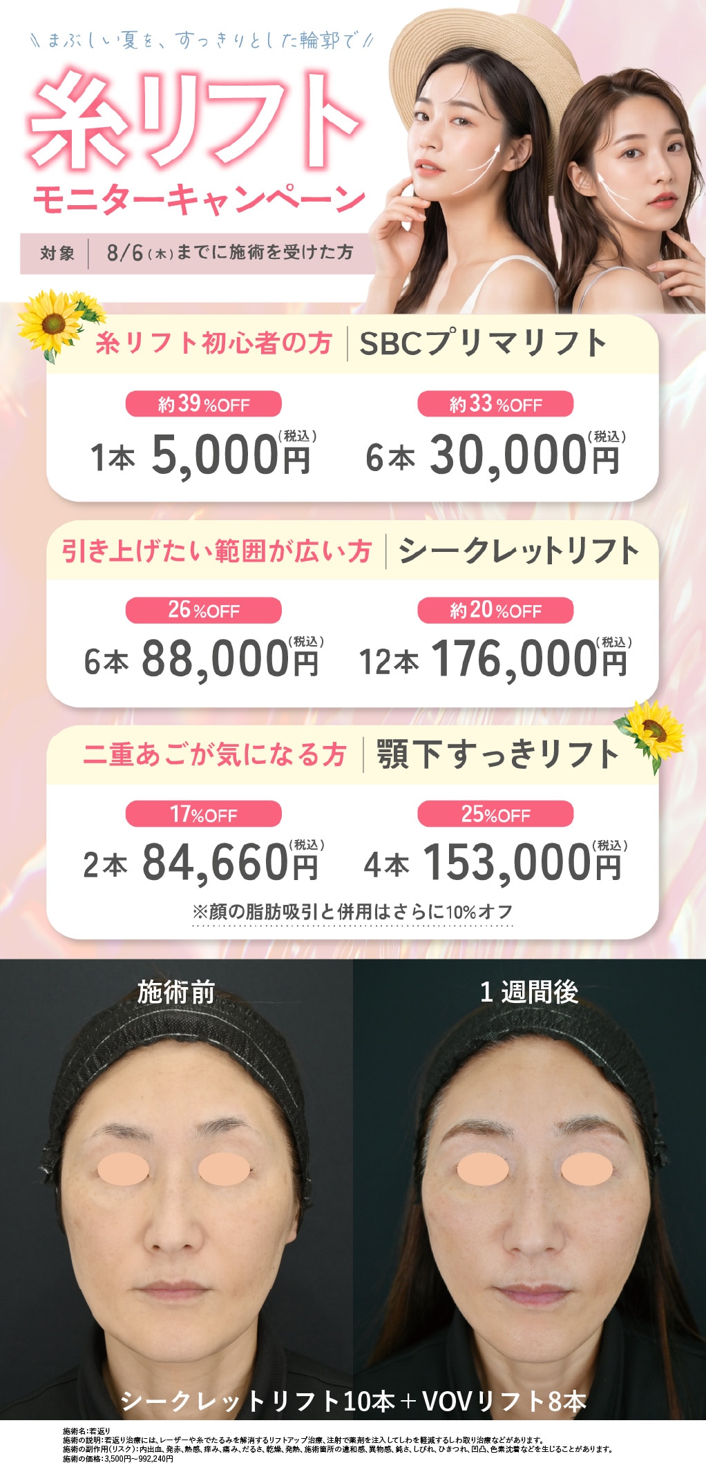 糸リフトキャンペーン | 湘南美容クリニック船橋院