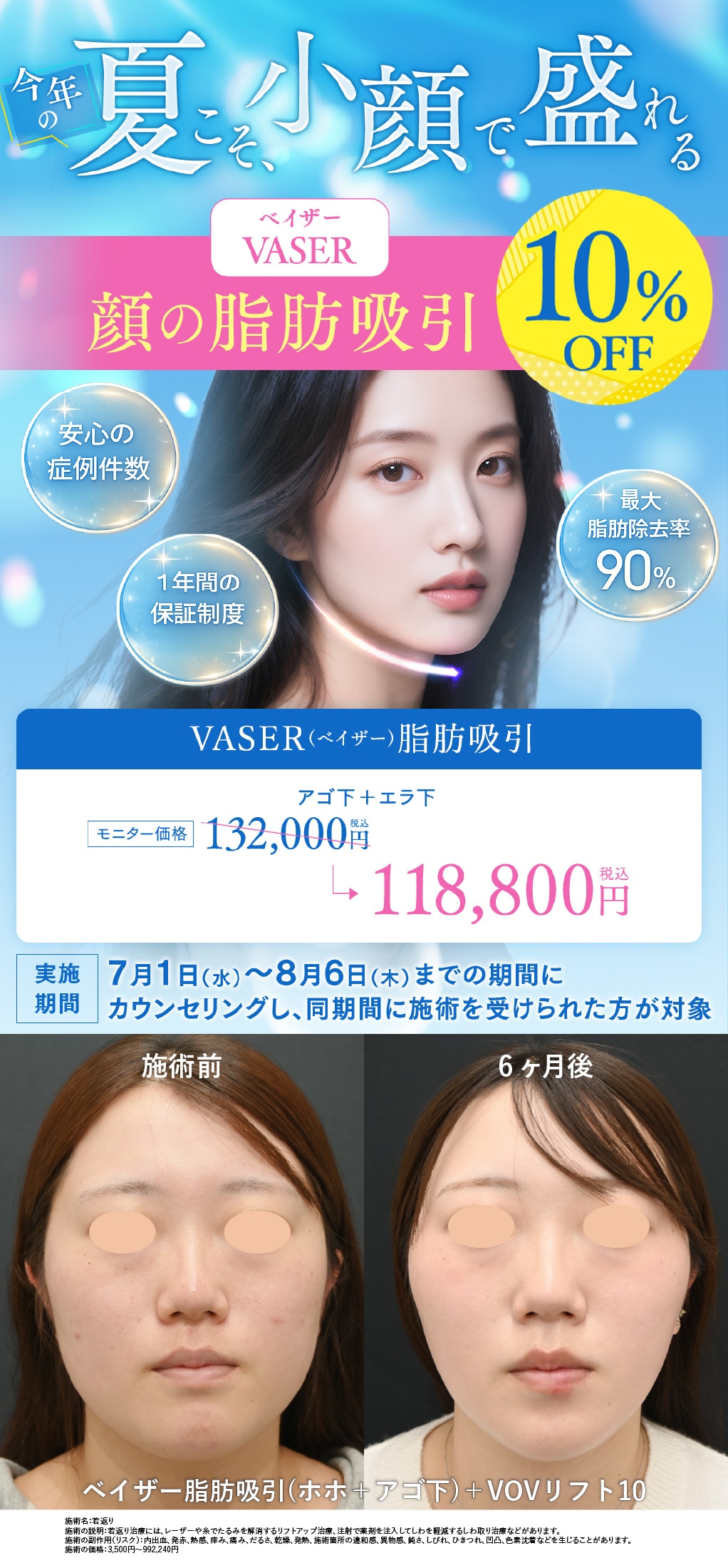 Vaser脂肪吸引キャンペーン | 湘南美容クリニック船橋院