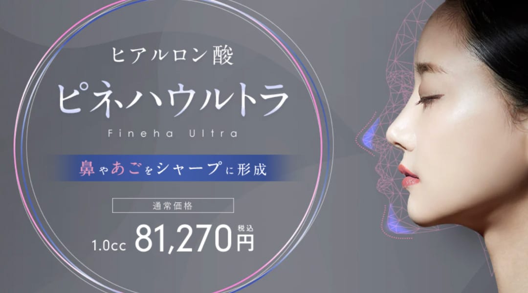 ピネハウルトラ