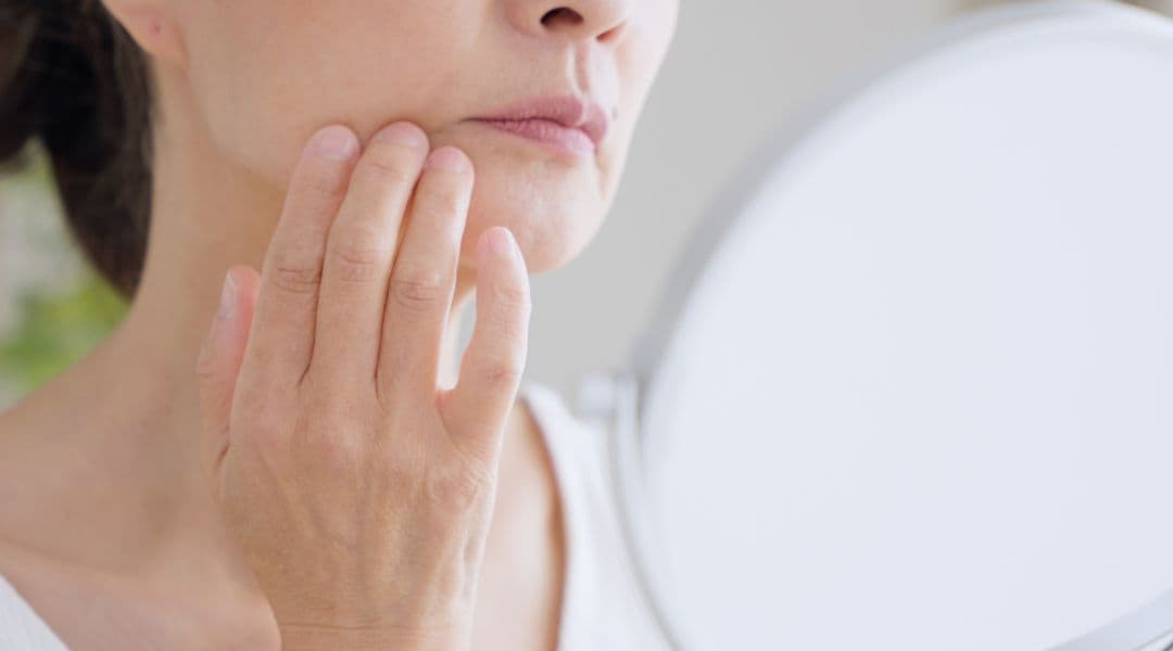 頬のコケや脂肪減少による輪郭への変化