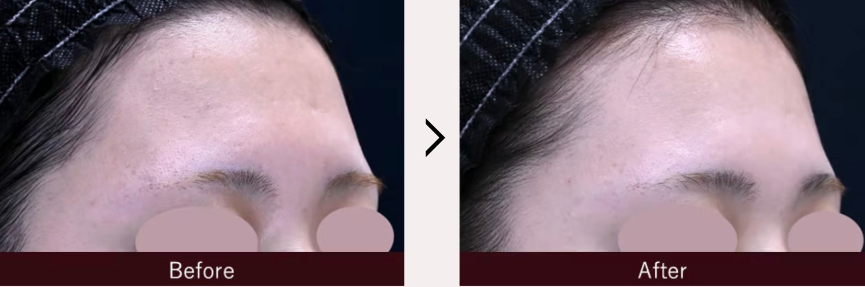 ヴェルヴェットスキン