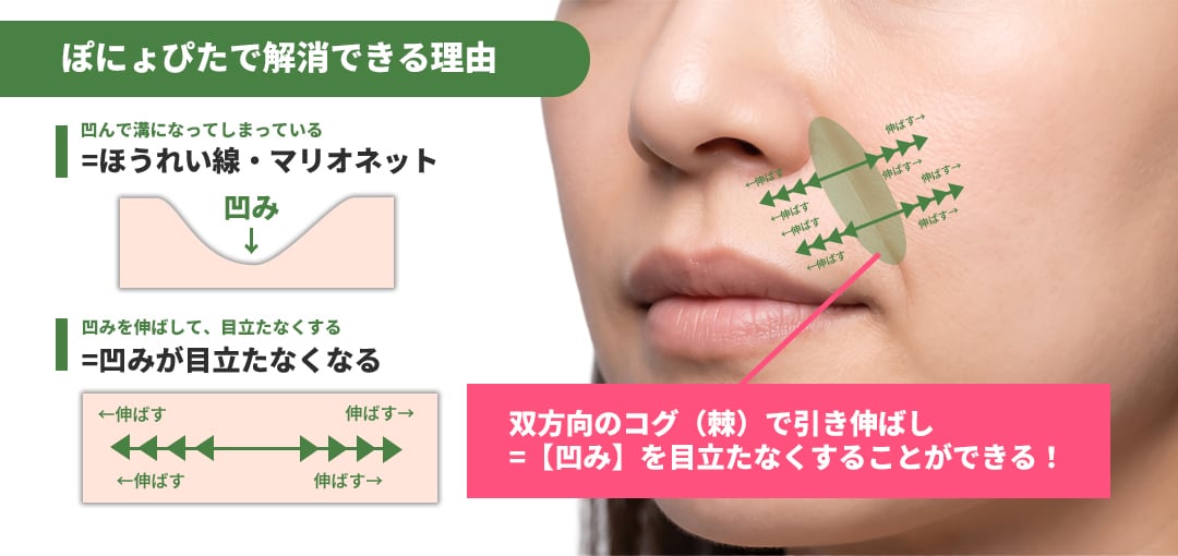 【ぽにょぴたスレッド】で解消できる理由