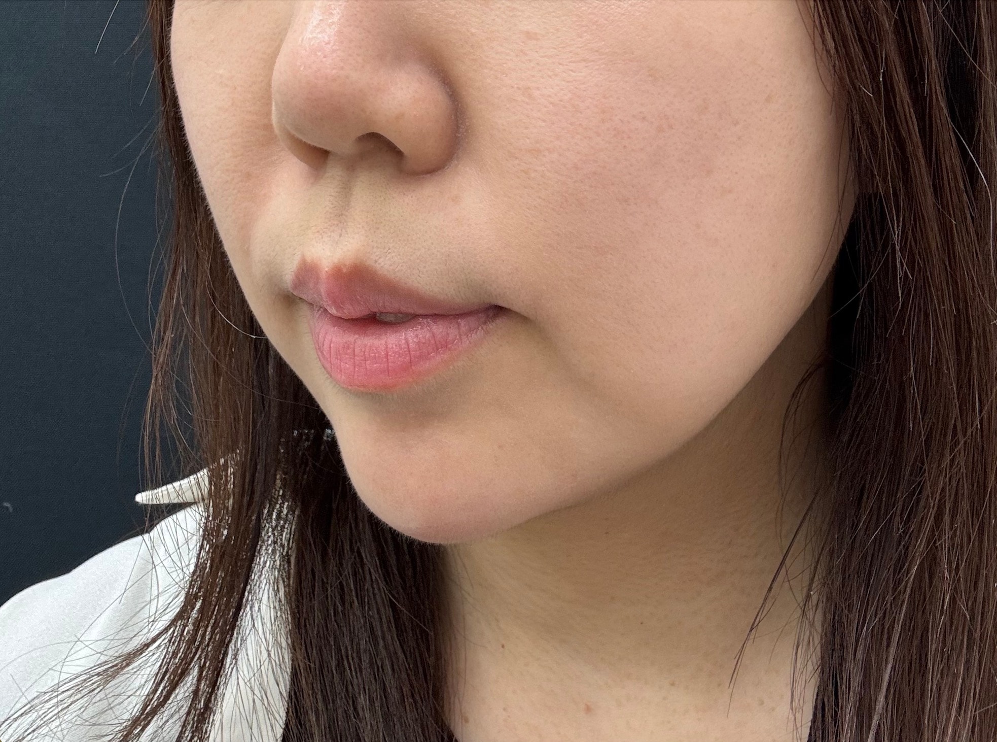 実際にスタッフが受けてみました
