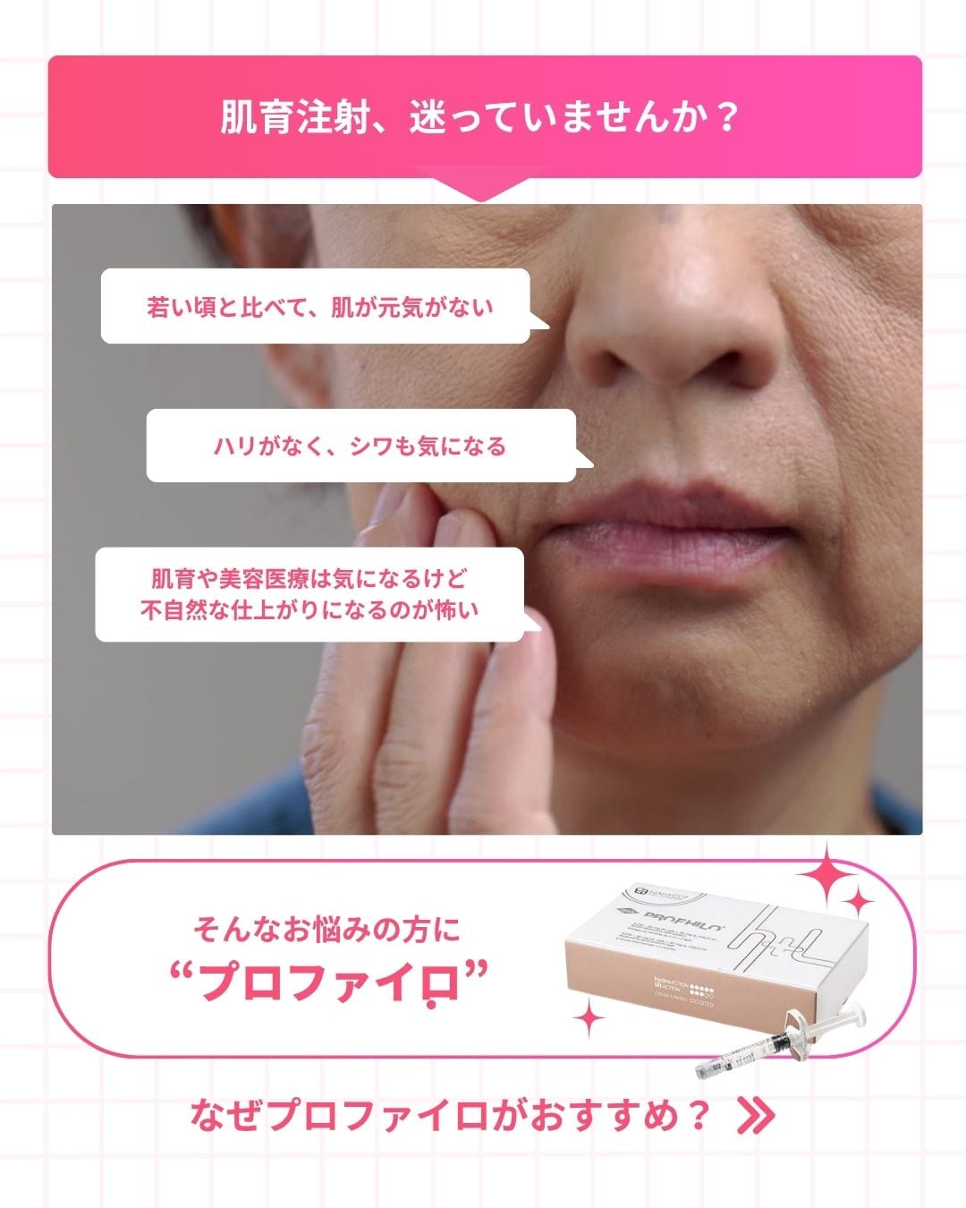 そんなお悩みに「プロファイロ」