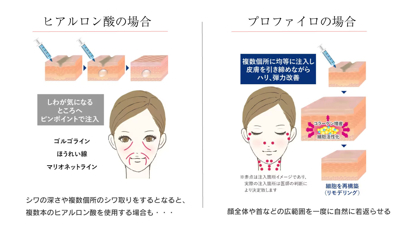 普通のヒアルロン酸との違いは？