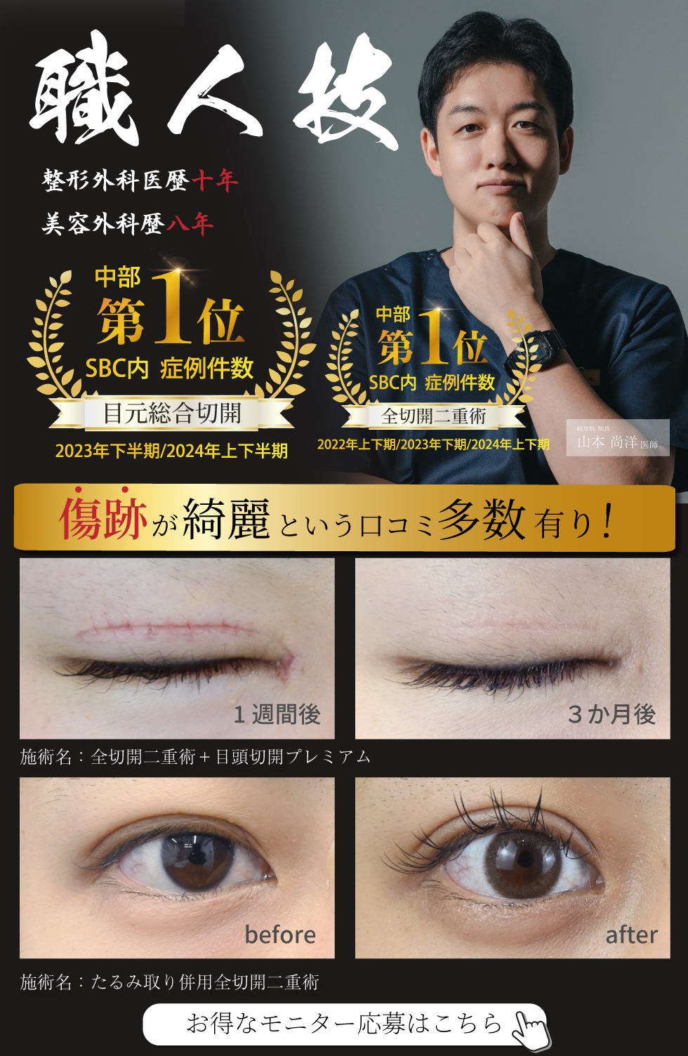 職人技の傷口