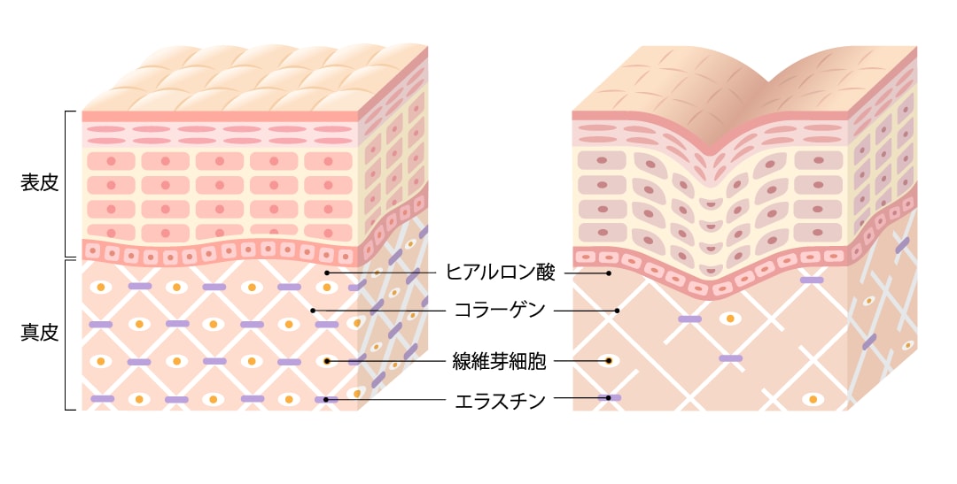 肌悩みを根本から改善