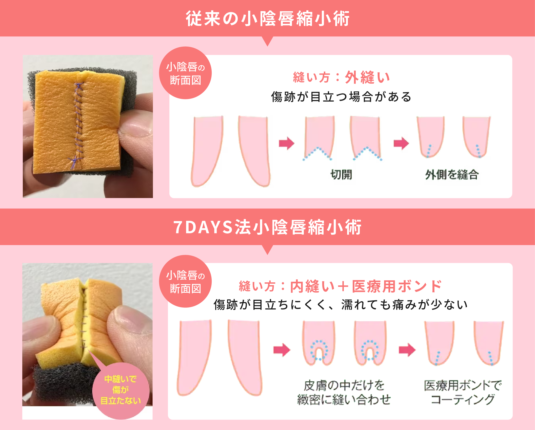 7DAYS法のメリット