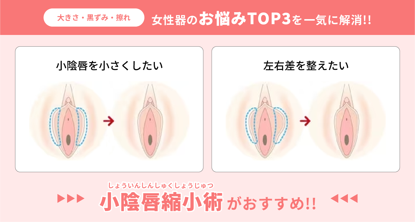 女性器の成長 