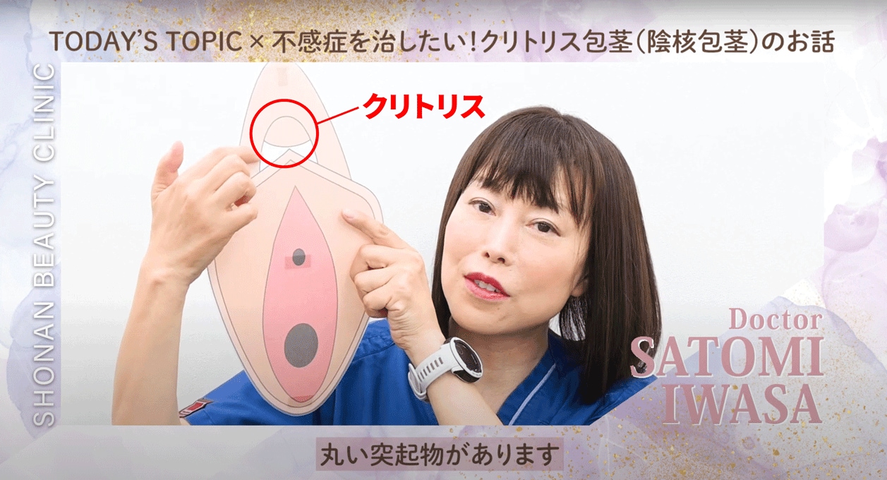 肥大化　クリトリス 
