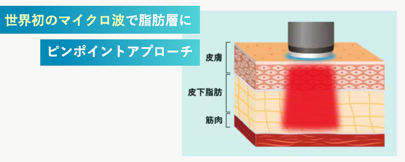 オンダリフトの仕組み