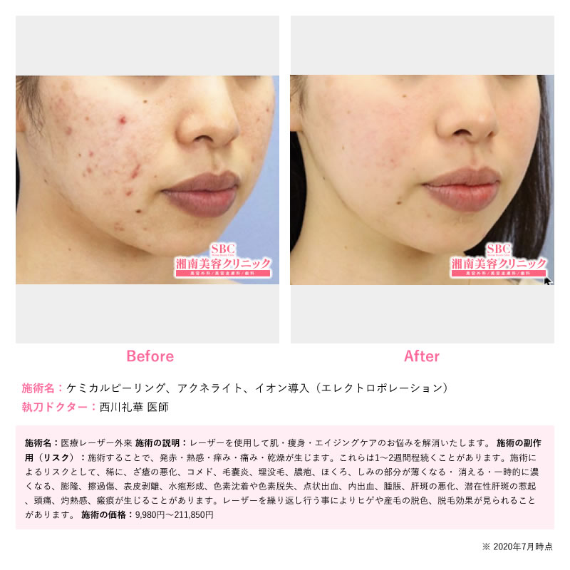 3. お悩みに合わせた薬剤塗布で相乗効果🧴