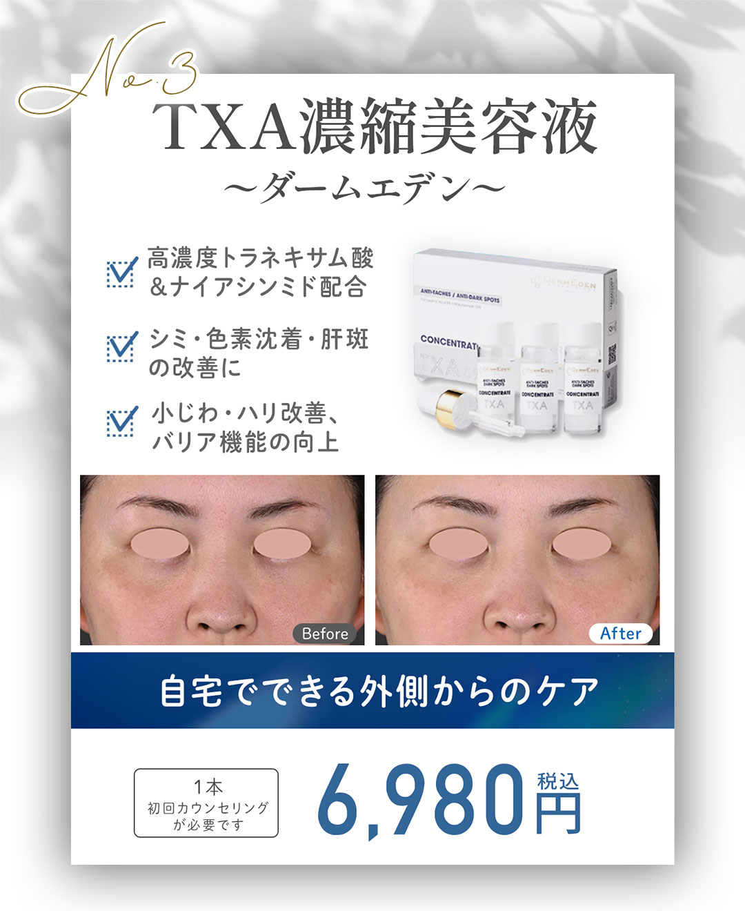 「自宅でできる本格的なシミ対策」をしたいあなたに