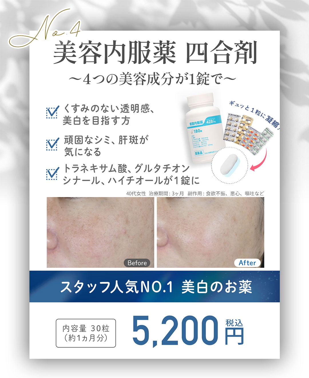 「頑固なシミを内側からしっかり撃退したい」あなたに