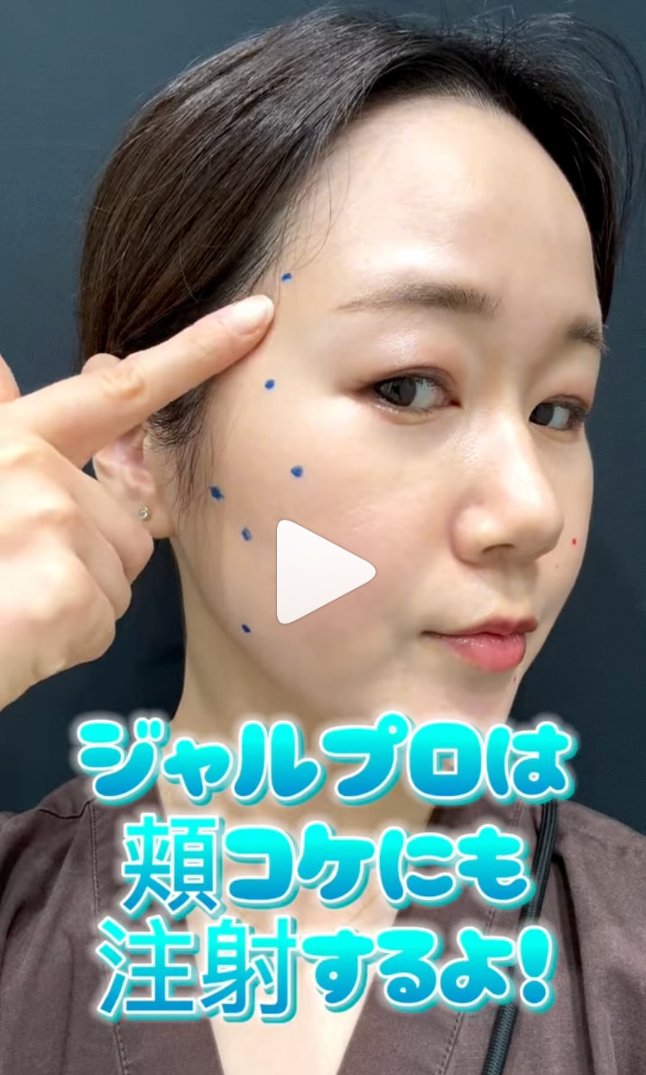 頬コケにも効果的【ジャルプロ】