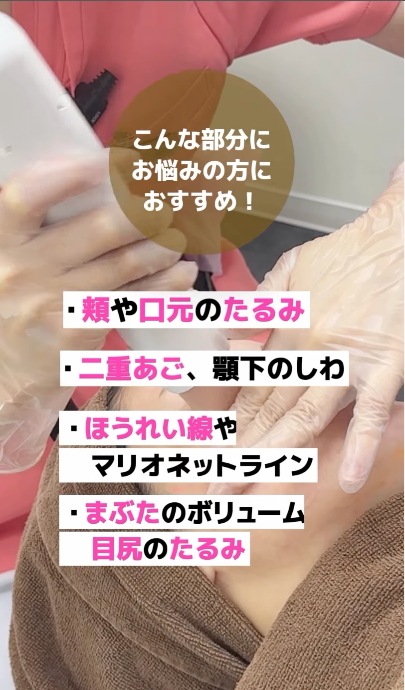 お顔の気になる部分にデザインをしながら、ピンポイントで「モノポーラRF」と「バイポーラRF」を照射していきます！