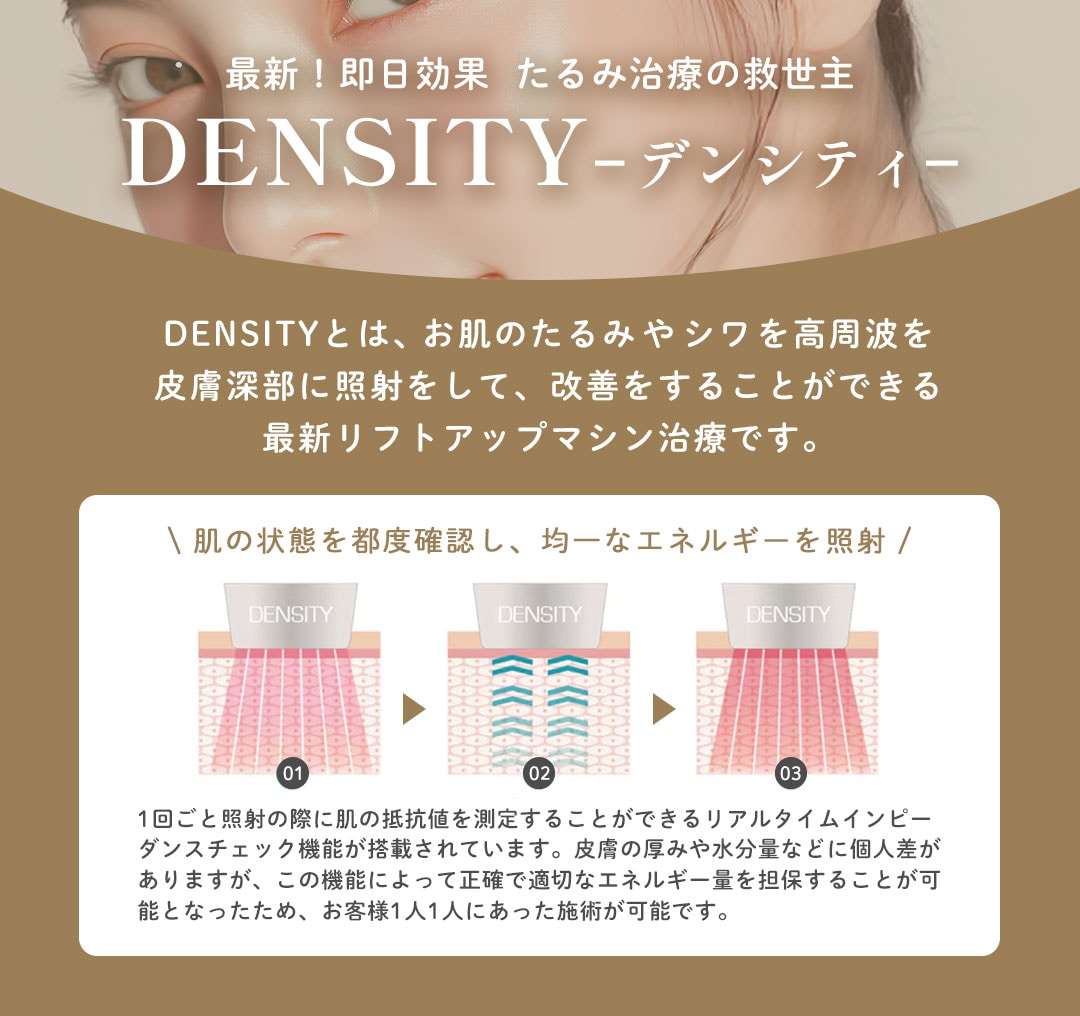 DENSITY (デンシティ) とは？