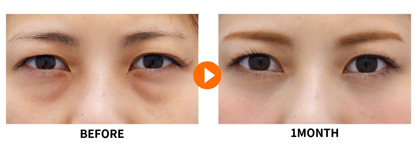 岩砂里美 院長の【切らないクマ取り】