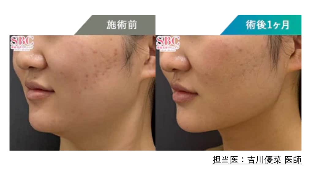 「小顔」も「美肌」も諦めない。イベント前日の駆け込み寺