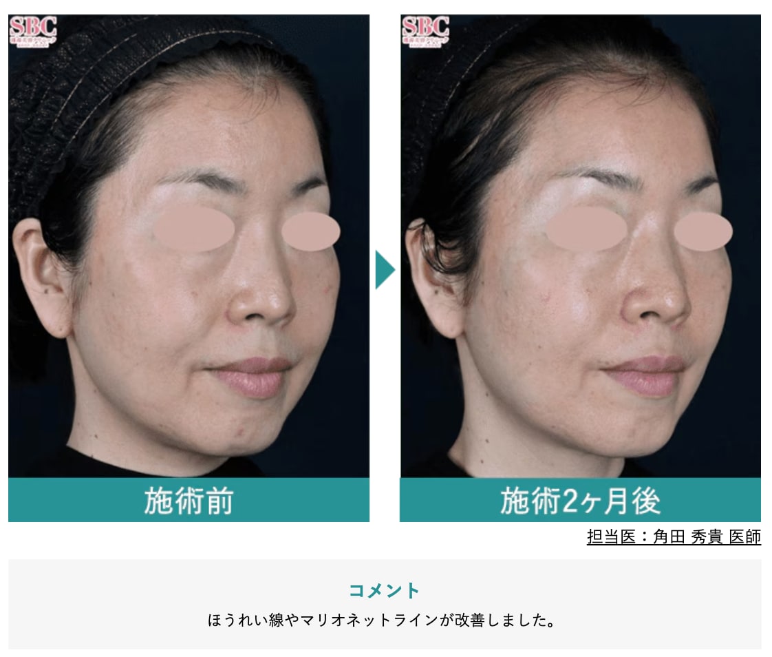 組み合わせによる相乗効果は？