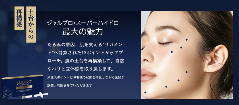 ジャルプロとは？