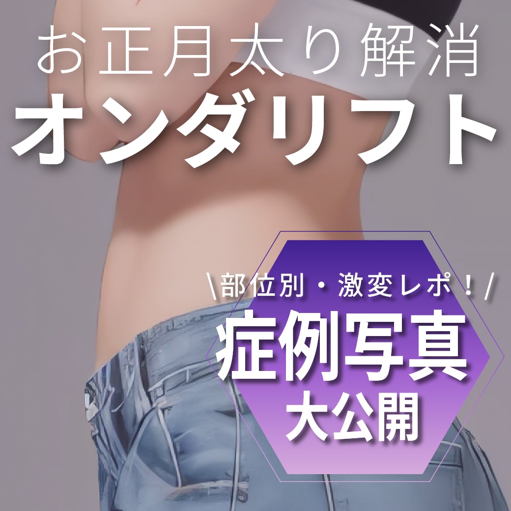 【保存版】オンダリフトの効果を症例写真で検証！ダウンタイムやビフォーアフターの経過を徹底解説