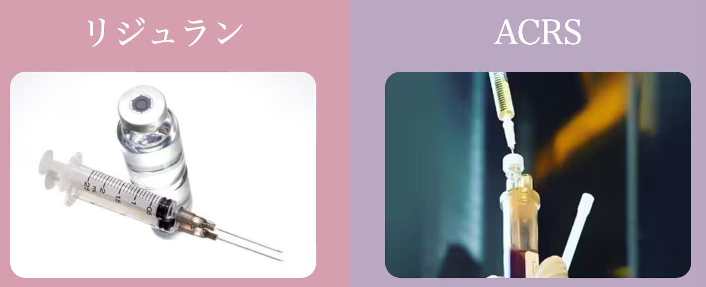 徹底比較：リジュランvs ACRS（自己血）、あなたに合うのはどっち？