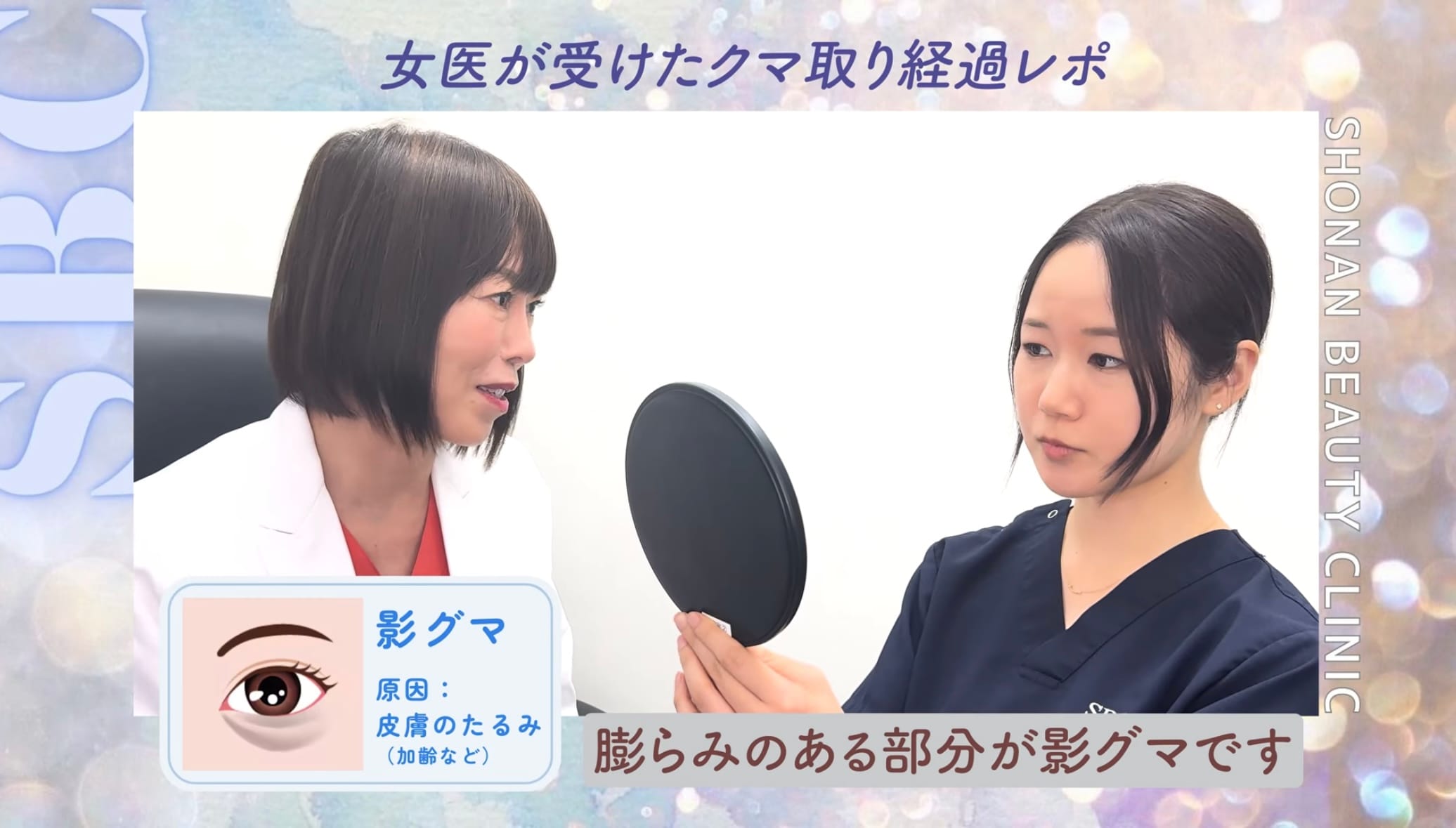 影グマ