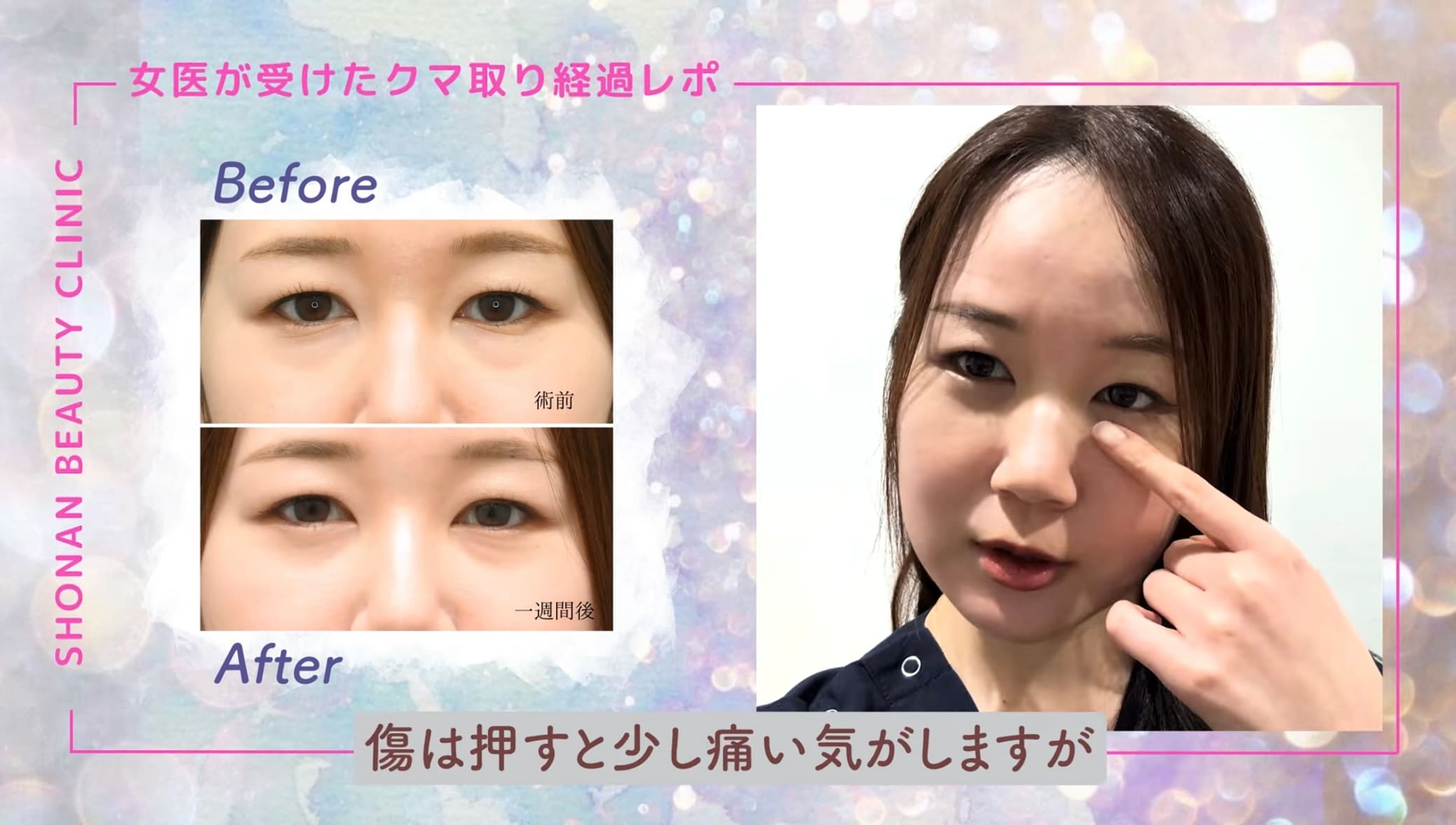 経過を女医がレポート