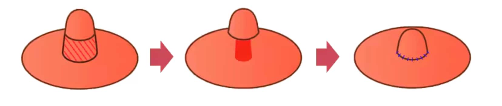 高さ縮小