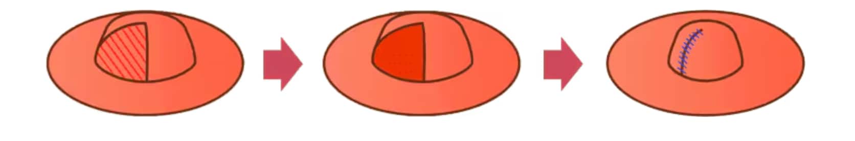 大きさ縮小
