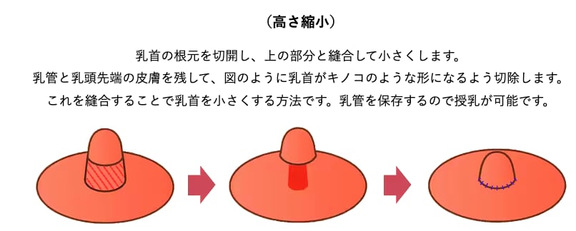 高さ縮小
