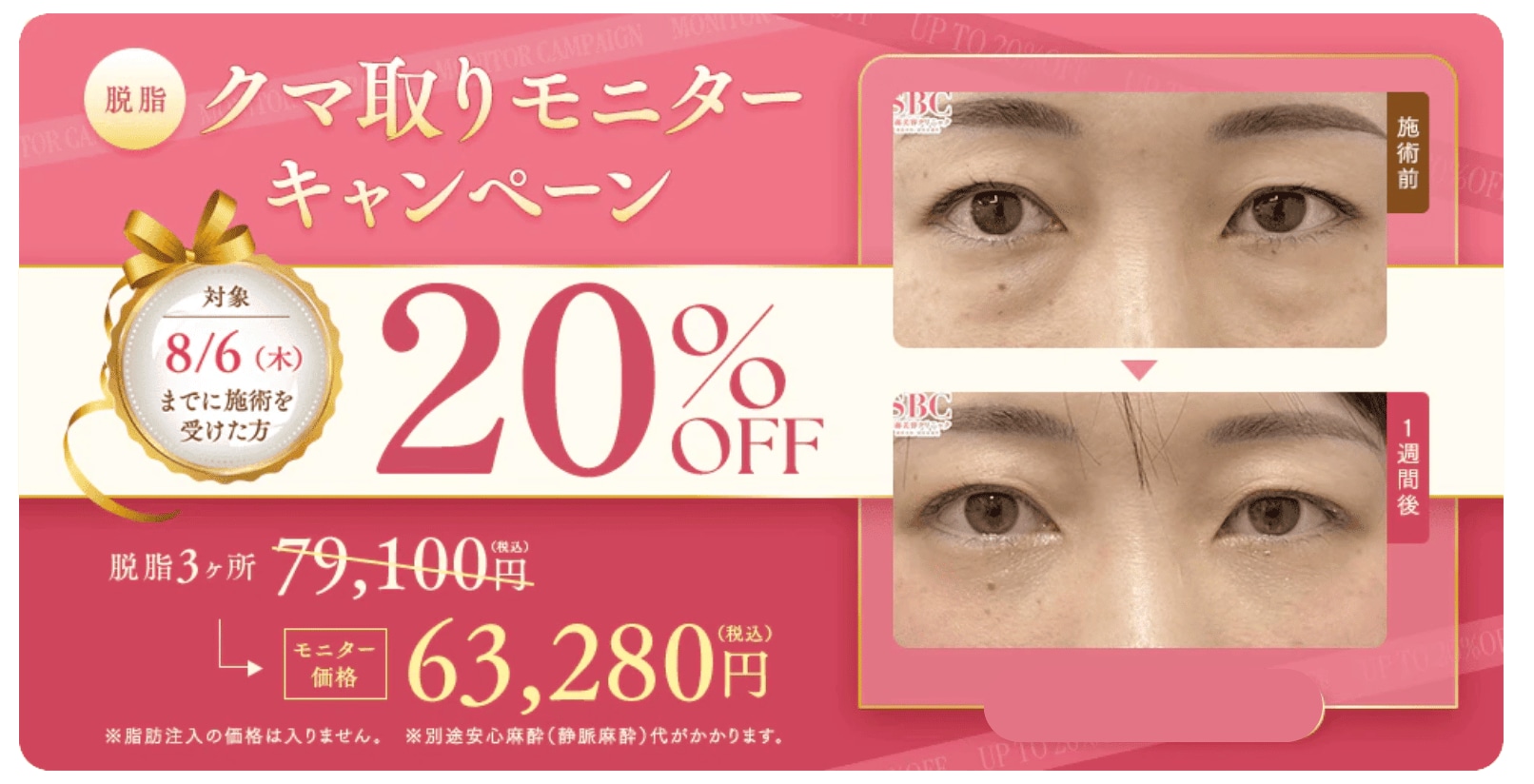 モニター価格より20%OFF<br />
79,100円 ⇒ 63,280円