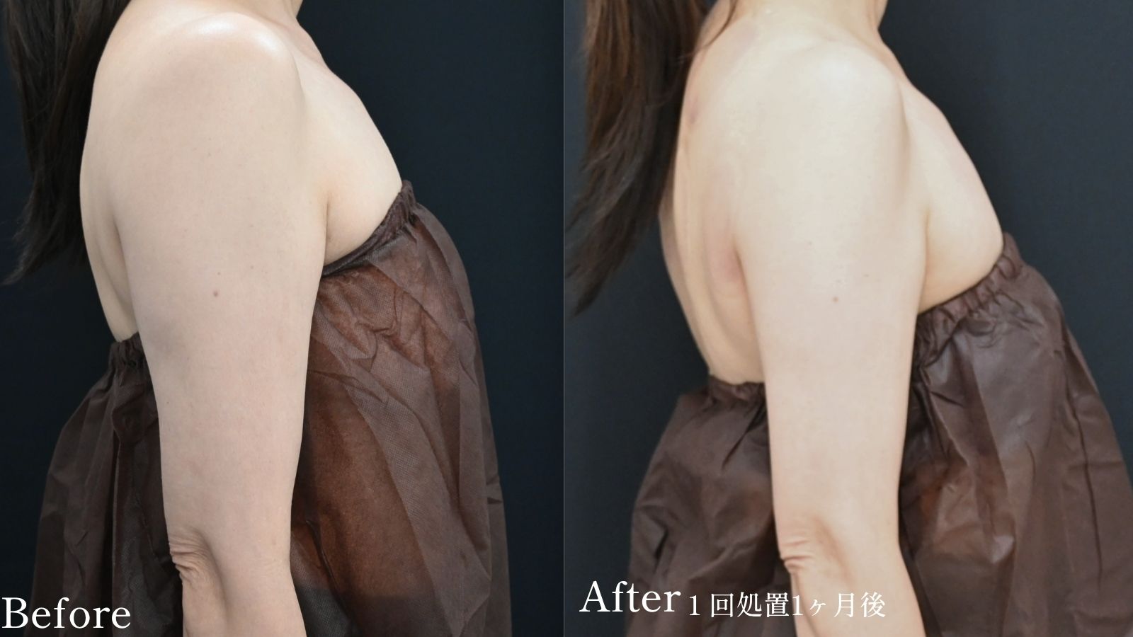 Before /After