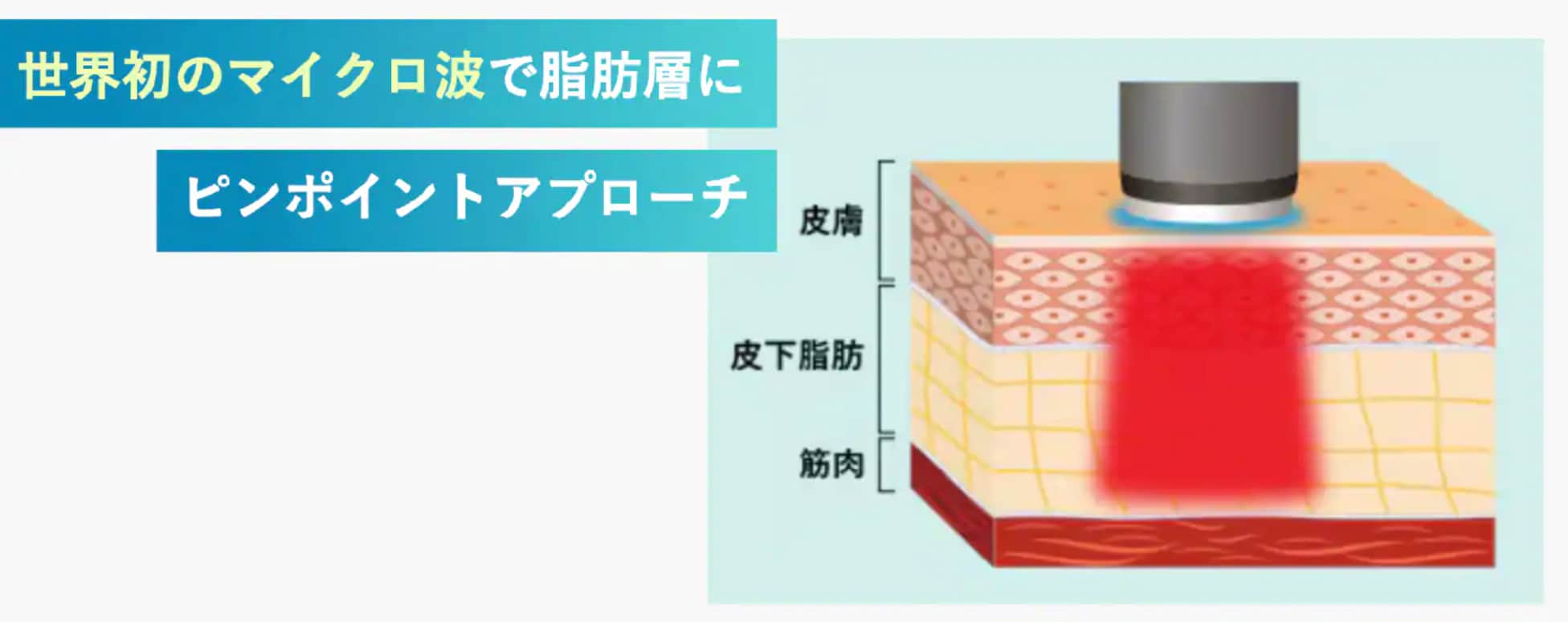切らない小顔・痩身施術