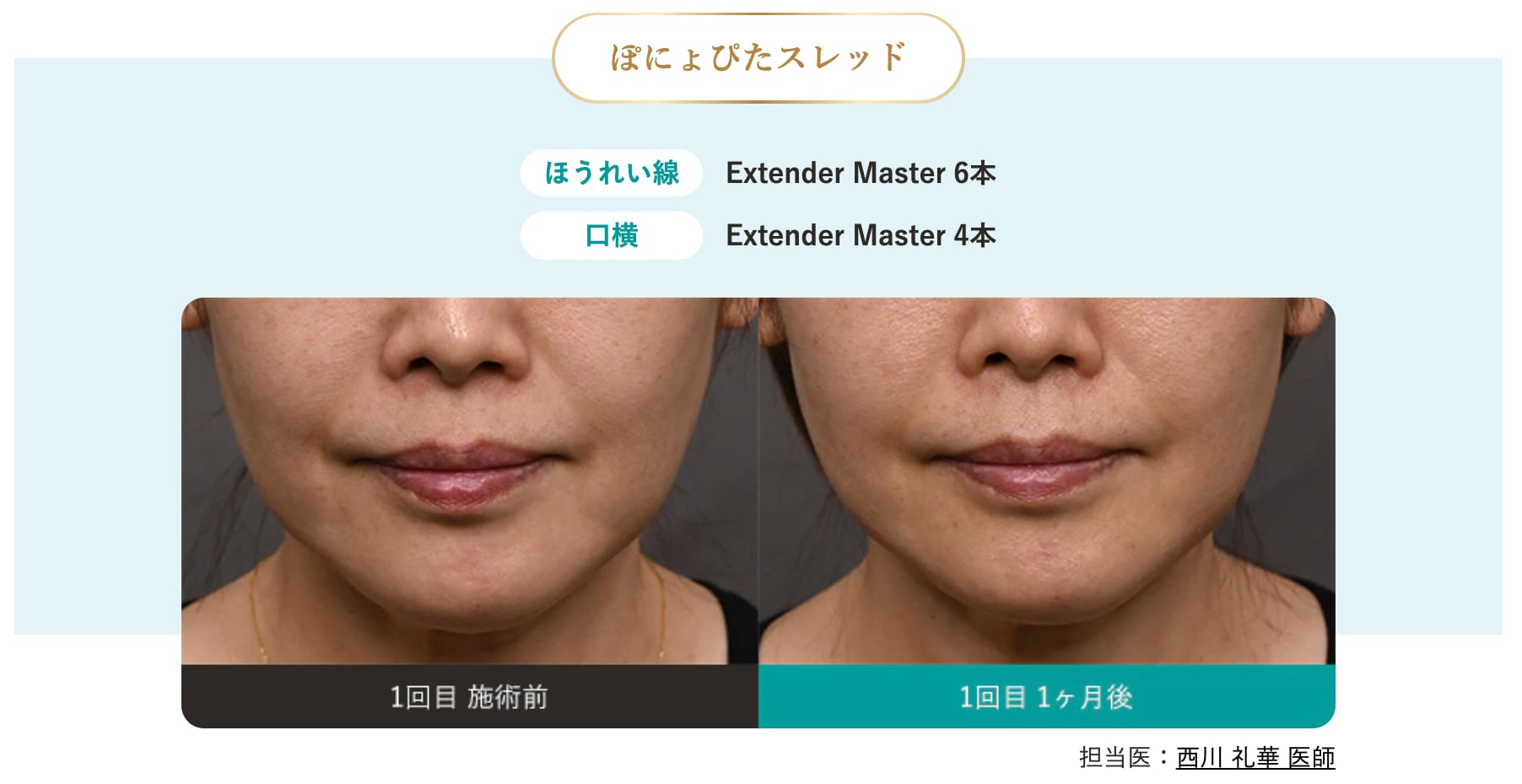 ぽにょぴたスレッド 施術イメージ