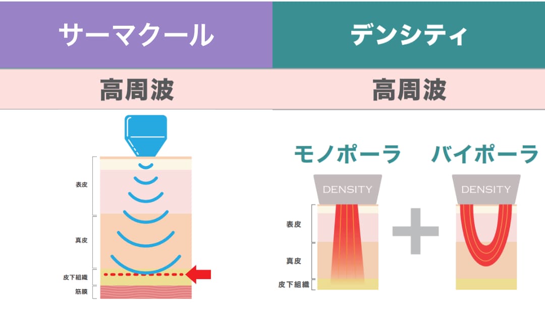 サーマクール デンシティ 高周波RF アプローチ図