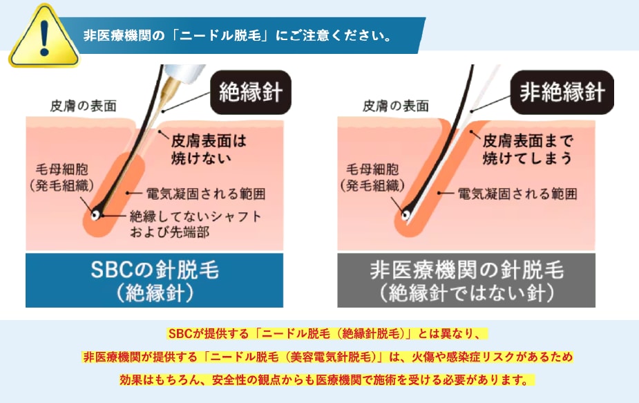 医療機関とサロンの違い