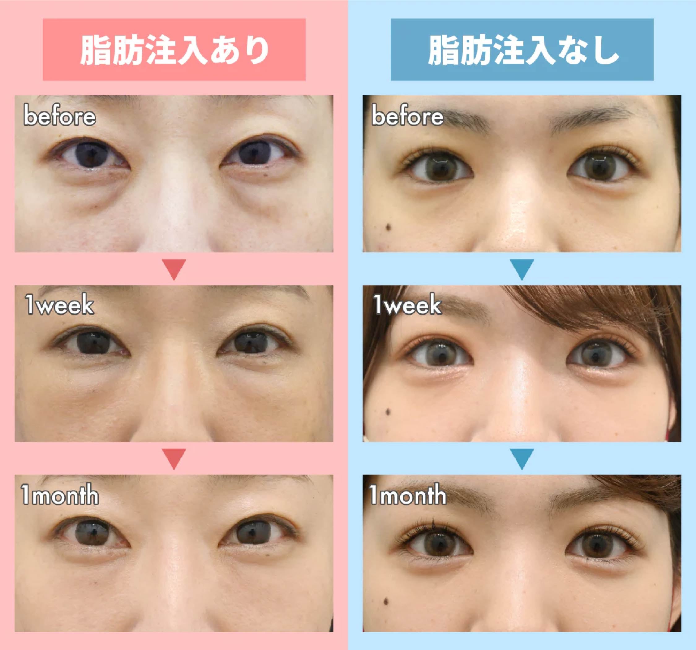 ダウンタイムの経過比較