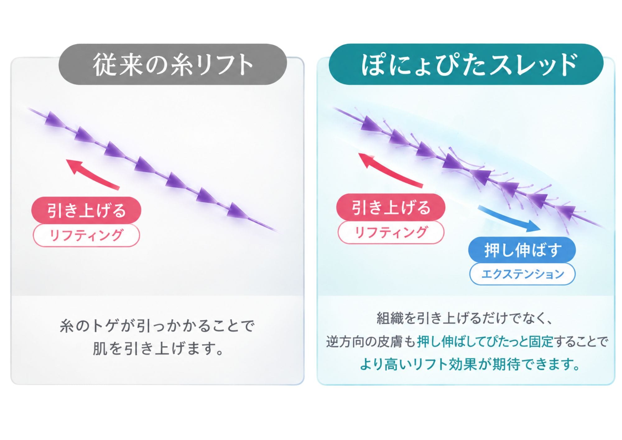 ぽにょぴたスレッド 施術イメージ