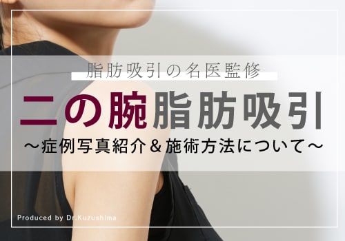 【東京で二の腕の脂肪吸引するなら】二の腕脂肪吸引の名医葛島先生の症例写真とこだわりの施術方法について