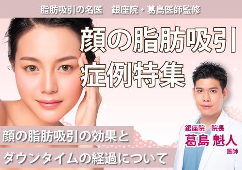 顔の脂肪吸引が上手い先生といえば湘南美容外科の葛島先生！症例写真を元に解説！