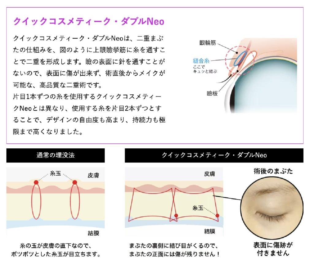 QCW術について