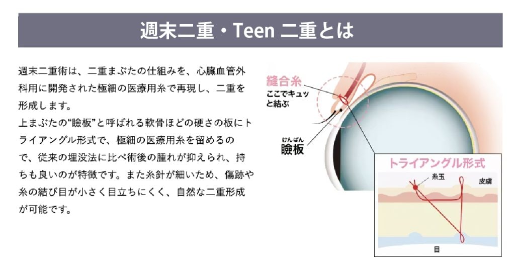 Teen週末二重術について