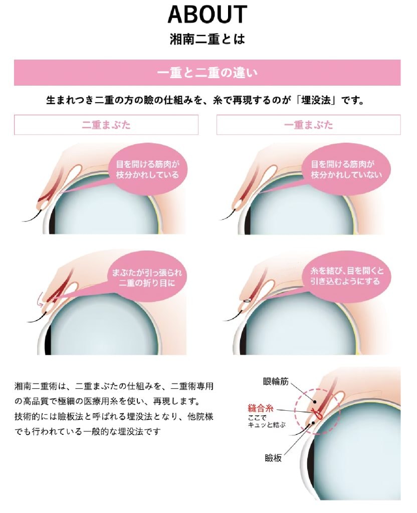 湘南二重術について