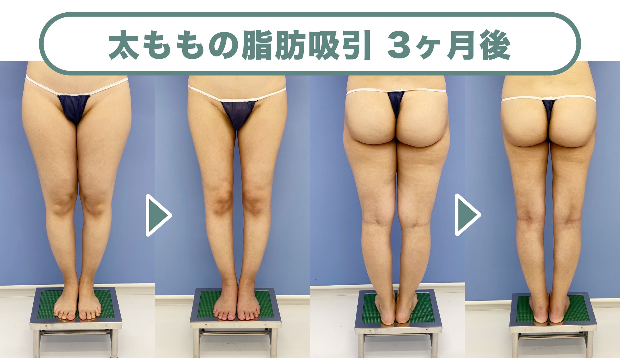 2017顔出しシミ付きパンツ 