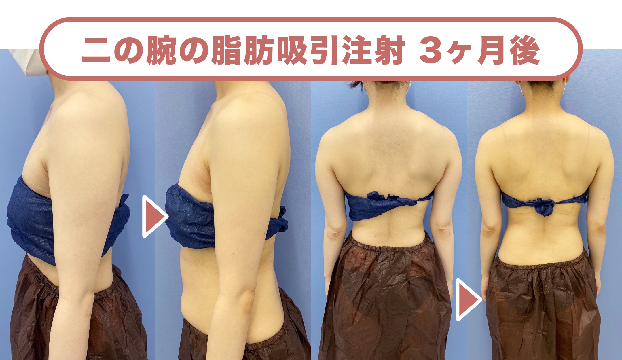 2017顔出しシミ付きパンツ 