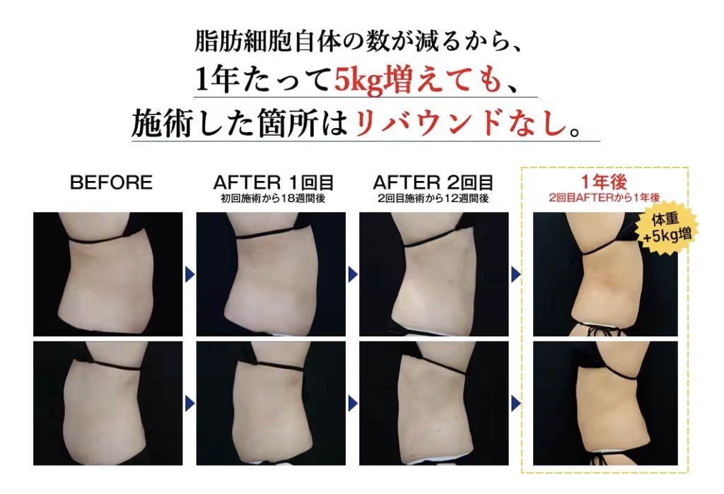クルスカ説明1_SBC銀座院