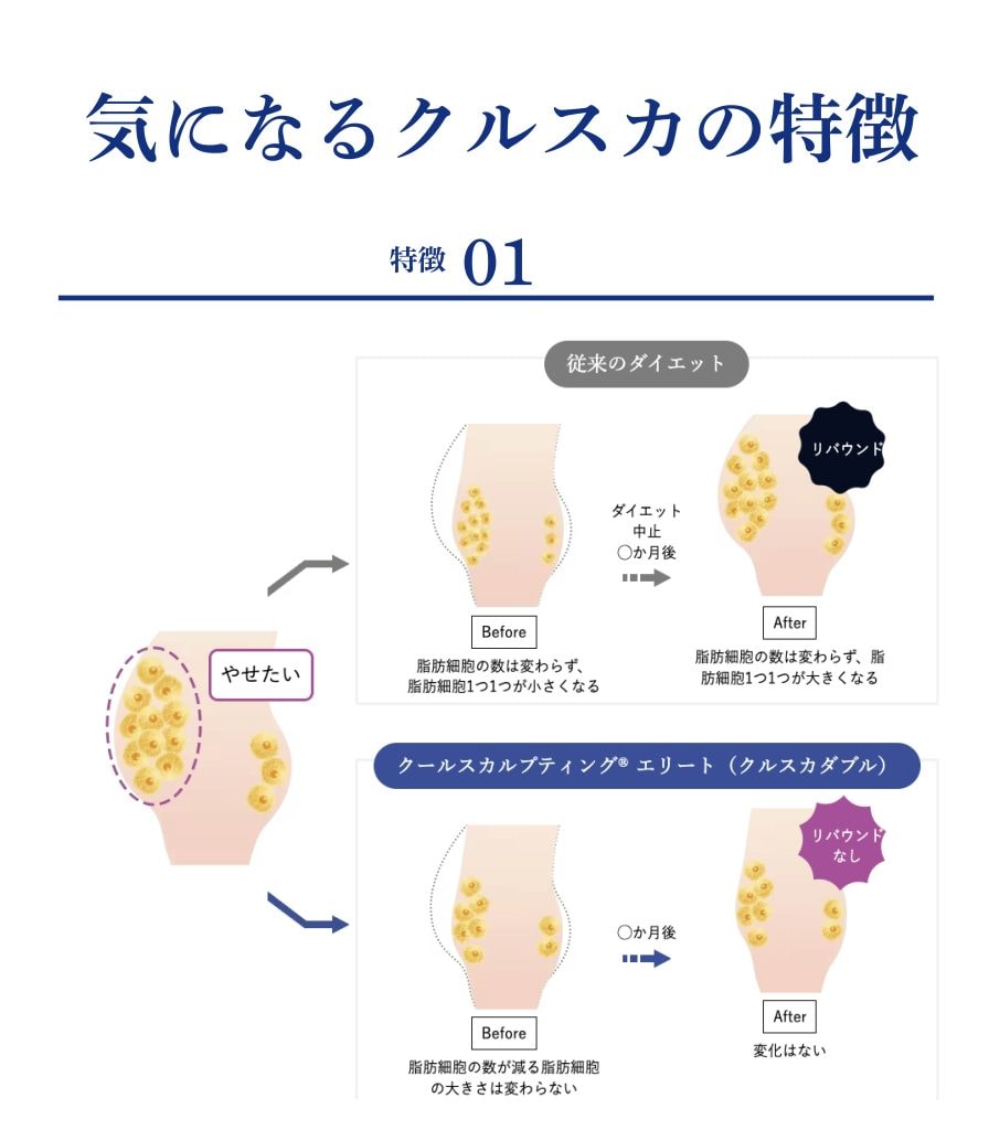 クルスカ特徴1_SBC銀座院