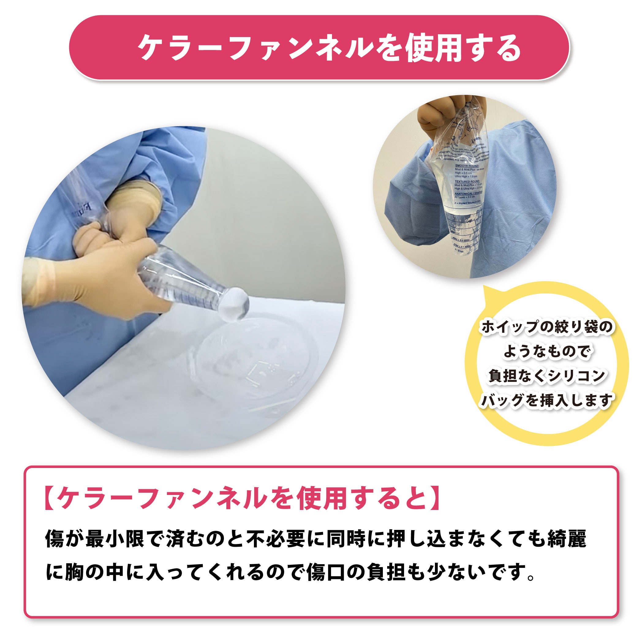 ファンネル と は